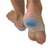 My Feet Silicone Gel Heel Spur Pads for Plantar Fasciitis and Heel Pain Relief Small